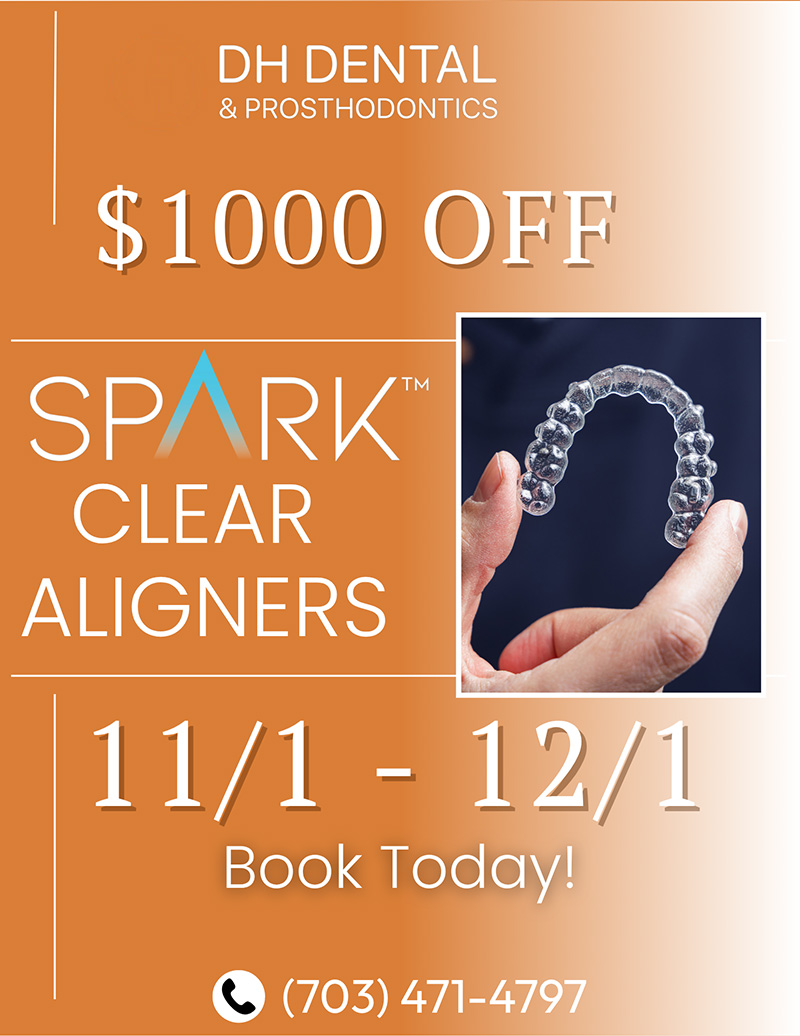 DH Dental Prosthodontics | Full Mouth Reconstruction, Dental Implants and All-on-X